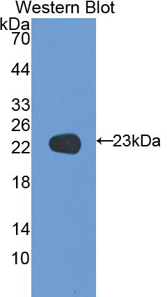 Coagulation Factor V (F5) Polyclonal Antibody - image 2