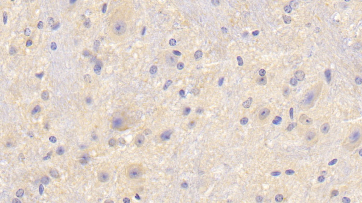 Coagulation Factor V (F5) Polyclonal Antibody - image 4