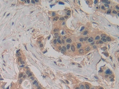 Slit Homolog 2 (Slit2) Polyclonal Antibody - image 3