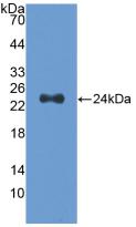 Slit Homolog 2 (Slit2) Polyclonal Antibody - image 2