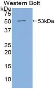 Western Blot; Sample: Lane1: Mouse Pancreas lysate; Lane2: Human Serum; Primary Ab: 2µg/mL Rabbit Anti-Human ANGPT4 Antibody; Second Ab: 0.2µg/mL HRP-Linked Caprine Anti-Rabbit IgG Polyclonal Antibody;