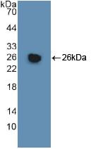 DAB staining on IHC-P; Samples: Human Liver Tissue; Primary Ab: 20μg/ml Rabbit Anti-Human GSTm1 Antibody Second Ab: 2µg/mL HRP-Linked Caprine Anti-Rabbit IgG Polyclonal Antibody