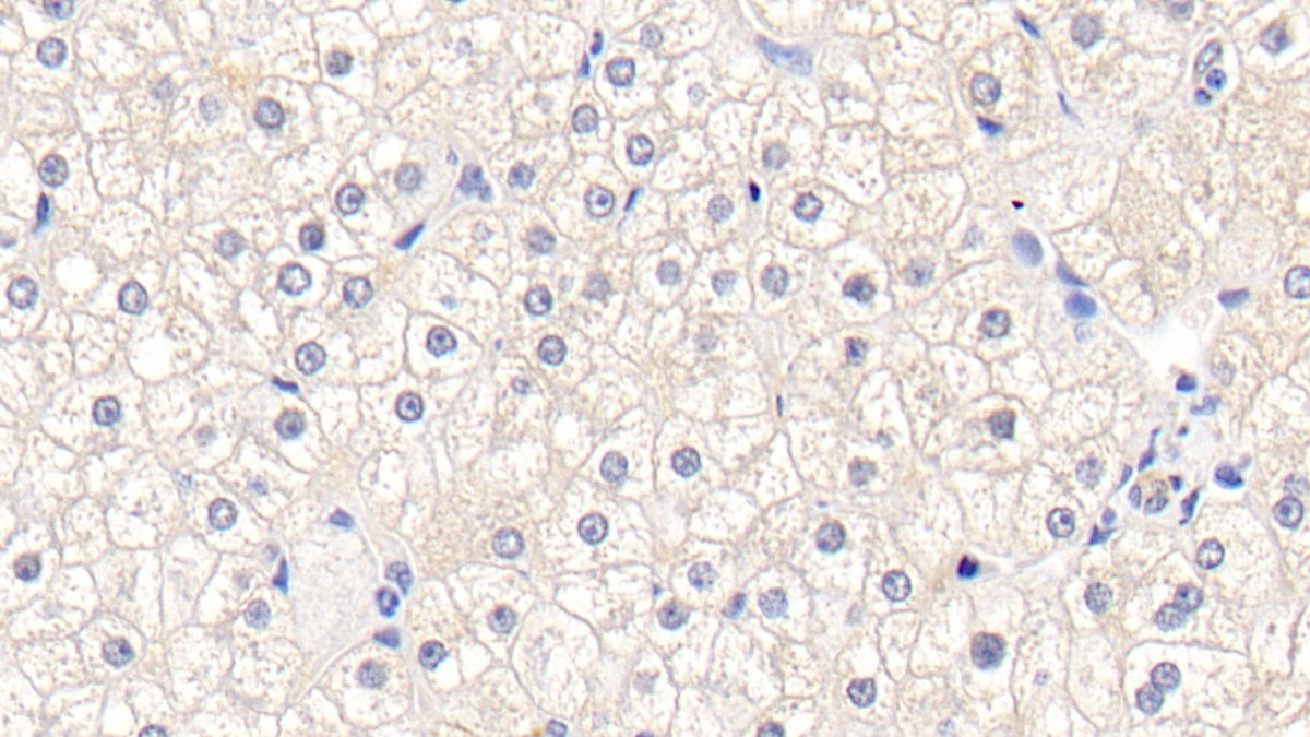 DAB staining on IHC-P; Samples: Human Kidney Tissue;  Primary Ab: 20μg/ml Rabbit Anti-Human GSTm1 Antibody Second Ab: 2µg/mL HRP-Linked Caprine Anti-Rabbit IgG Polyclonal Antibody