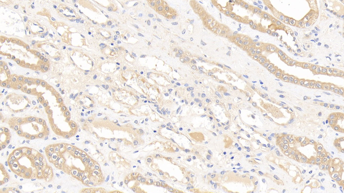Glutathione S Transferase Mu 1 (GSTM1) Polyclonal Antibody - image 5