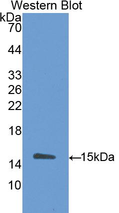 Western Blot; Sample: Lane1: Human Urine; Lane2: Rat Placenta lysate; Primary Ab: 2μg/ml Rabbit Anti-Rat DAO Antibody; Second Ab: 0.2µg/mL HRP-Linked Caprine Anti-Rabbit IgG Polyclonal Antibody;