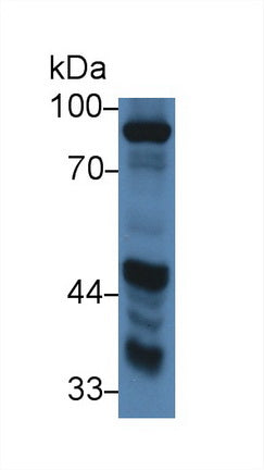 Western Blot; Sample: Recombinant protein.