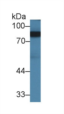 Western Blot; Sample: Recombinant protein.