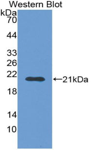 DAB staining on IHC-P; Samples: Mouse Kidney Tissue;  Primary Ab: 20µg/ml Rabbit Anti-Mouse DAO Antibody Second Ab: 2µg/mL HRP-Linked Caprine Anti-Rabbit IgG Polyclonal Antibody