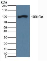 Western Blot; Sample: Recombinant protein.