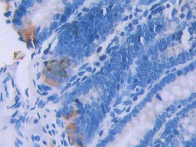 DAB staining on IHC-P; Samples: Rat Stomach Tissue.