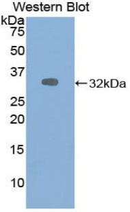 DAB staining on IHC-P; Samples: Human Cerebrum Tissue; Primary Ab: 20µg/ml Rabbit Anti-Human ALDOA Antibody Second Ab: 2µg/mL HRP-Linked Caprine Anti-Rabbit IgG Polyclonal Antibody