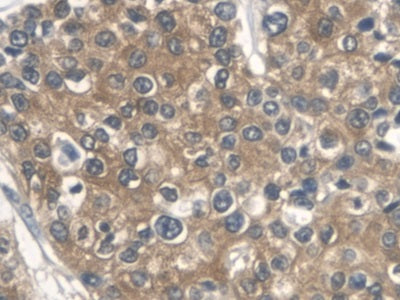 Aldolase A, Fructose Bisphosphate (ALDOA) Polyclonal Antibody - image 5