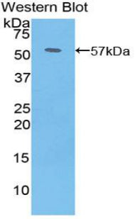 Platelet Derived Growth Factor BB (PDGF BB) Polyclonal Antibody - image 2