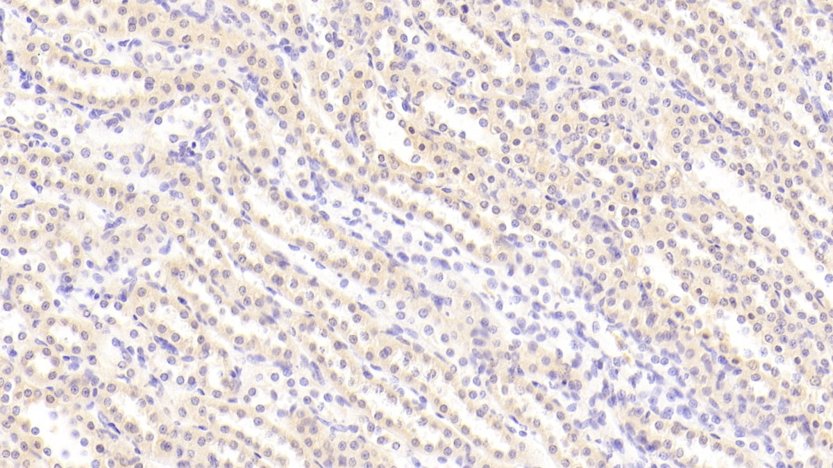 DAB staining on fromalin fixed paraffin-embedded smooth muscle tissue)