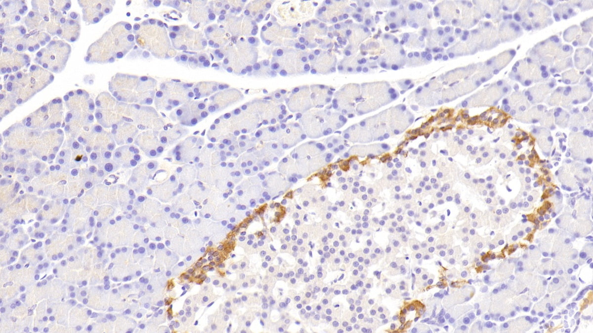 Platelet Derived Growth Factor BB (PDGF BB) Polyclonal Antibody - image 4