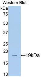 DAB staining on IHC-P; Samples: Mouse Kidney Tissue; Primary Ab: 20µg/ml Rabbit Anti-Mouse MK Antibody Second Ab: 2µg/mL HRP-Linked Caprine Anti-Rabbit IgG Polyclonal Antibody