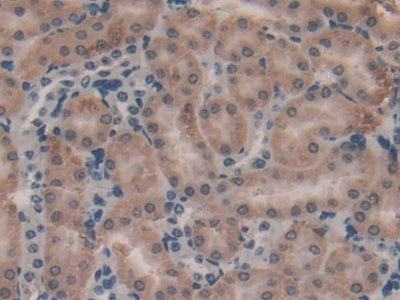 DAB staining on fromalin fixed paraffin- embedded liver tissue)