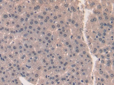 Midkine (MK) Polyclonal Antibody - image 5