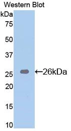 DAB staining on IHC-P; Samples: Rat Spleen Tissue; Primary Ab: 20ug/ml Rabbit Anti-Mouse Bid Antibody Second Ab: 2µg/mL HRP-Linked Caprine Anti-Rabbit IgG Polyclonal Antibody