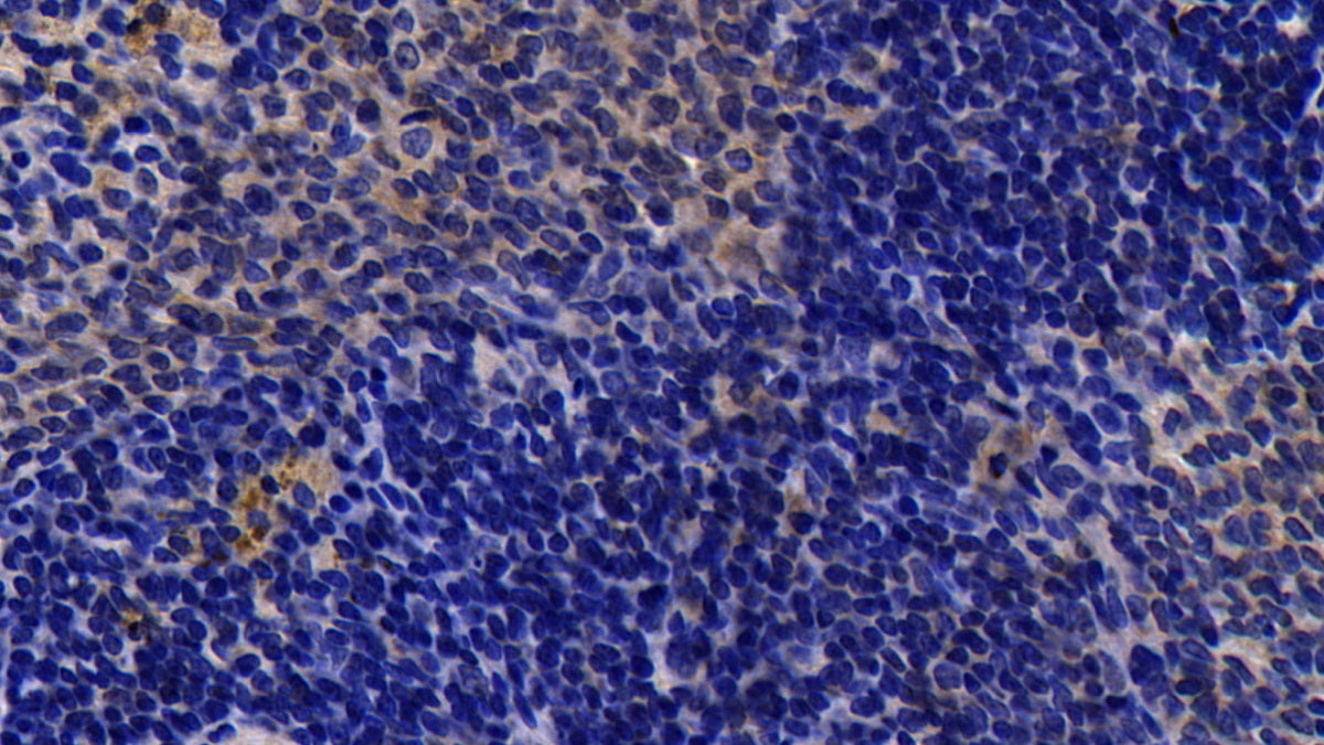 DAB staining on fromalin fixed paraffin- embedded spleen tissue)