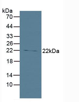 Western Blot; Sample: Lane1: Human Lung lysate; Lane2: Jurkat cell lysate; Lane3: Hela cell lysate; Lane4: A431 cell lysate; Lane5: MCF7 cell lysate; Primary Ab: 0.2ug/ml Rabbit Anti-Human Bid Antibody; Second Ab: 0.2µg/mL HRP-Linked Caprine Anti-Rabbit IgG Polyclonal Antibody;