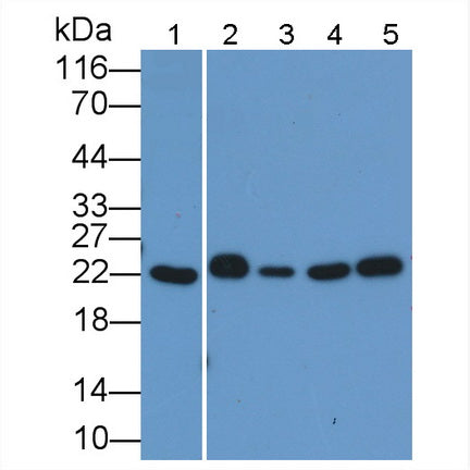 DAB staining on IHC-P; Samples: Human Cerebrum Tissue; Primary Ab: 20μg/ml Rabbit Anti-Human Bid Antibody Second Ab: 2µg/mL HRP-Linked Caprine Anti-Rabbit IgG Polyclonal Antibody