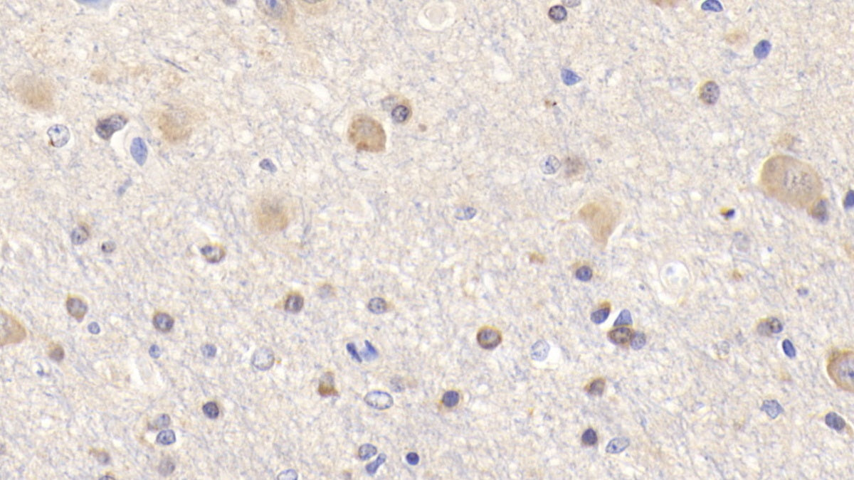 DAB staining on fromalin fixed paraffin-embedded Spleen tissue)
