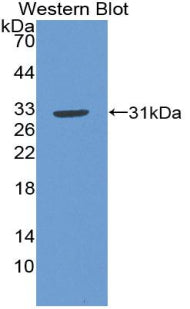 Nitric Oxide Synthase Trafficker (NOSTRIN) Polyclonal Antibody - image 2