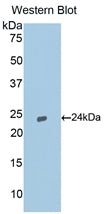 Western Blot; Sample: Lane1: Rat Uterus lysate; Lane2: Rat Placenta lysate; Lane3: Rat Bladder lysate; Lane4: Mouse Spleen lysate; Lane5: Mouse Testis lysate; Lane6: Porcine Uterus lysate; Lane7: 3T3-L1 cell lysate; Primary Ab: 0.5μg/ml Rabbit Anti-Rat CASP9 Antibody; Second Ab: 0.2µg/mL HRP-Linked Caprine Anti-Rabbit IgG Polyclonal Antibody;