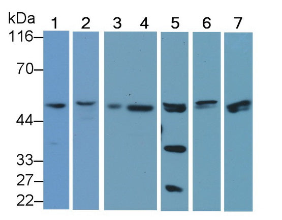 DAB staining on IHC-P; Samples: Rat Uterus Tissue; Primary Ab: 30ug/ml Rabbit Anti-Rat CASP9 Antibody Second Ab: 2µg/mL HRP-Linked Caprine Anti-Rabbit IgG Polyclonal Antibody