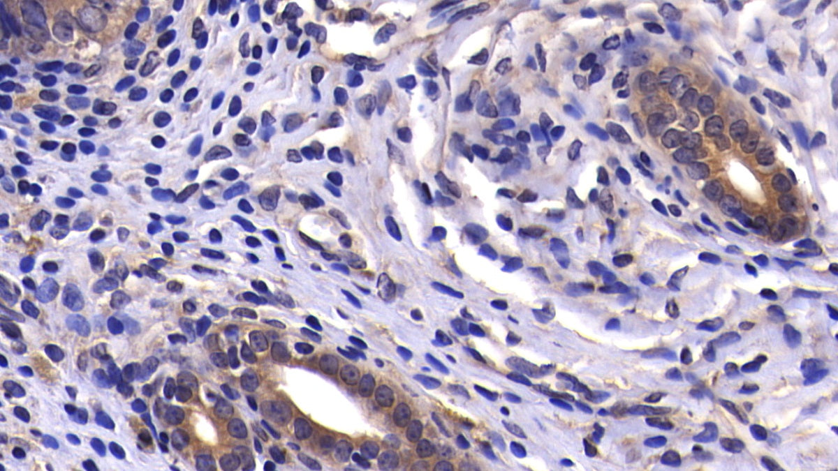 DAB staining on fromalin fixed paraffin- embedded stomach tissue)
