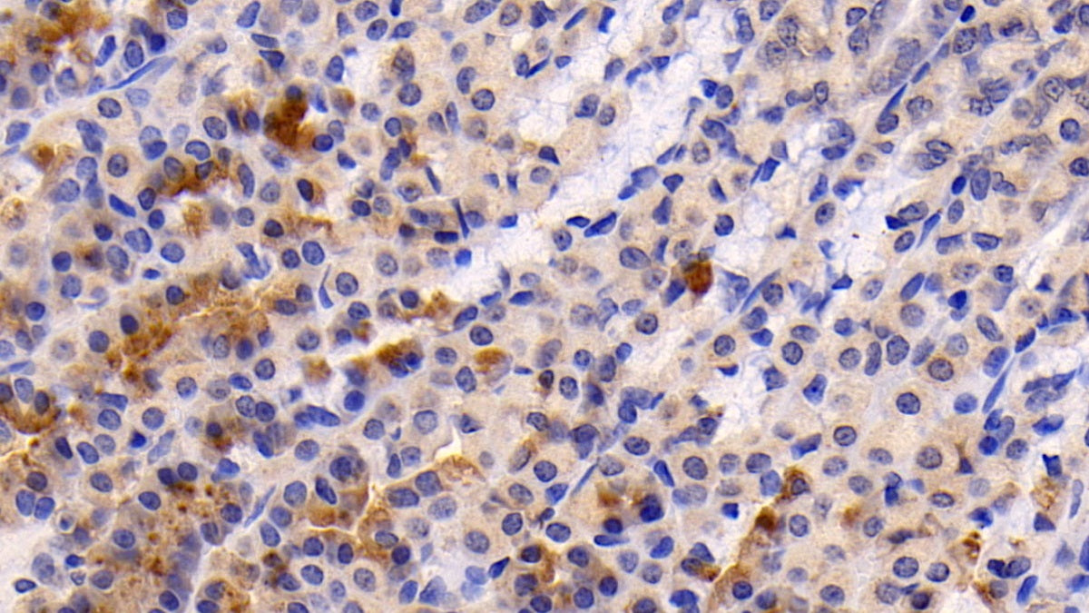DAB staining on fromalin fixed paraffin- embedded liver tissue)