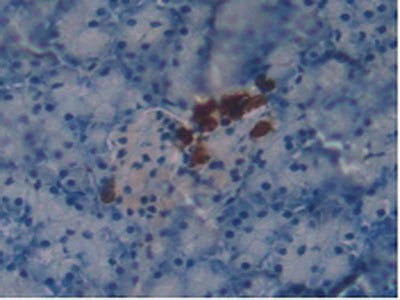 Glutathione S Transferase Omega 1 (GSTo1) Polyclonal Antibody - image 5