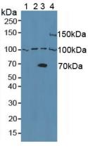 Western Blot; Sample: Recombinant ADAM8, Mouse.