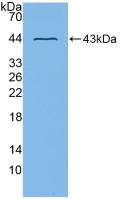 Used in DAB staining on fromalin fixed paraffin-embedded Liver tissue