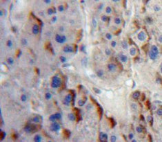 A Disintegrin And Metalloprotease 8 (ADAM8) Polyclonal Antibody - image 4