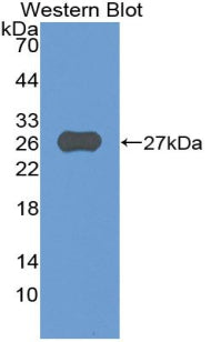 A Disintegrin And Metalloprotease 8 (ADAM8) Polyclonal Antibody - image 2