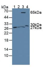 Western Blot; Sample: Recombinant GSTt2, Rat.
