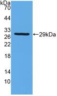 DAB staining on IHC-P; Samples: Rat Spinal cord Tissue; Primary Ab: 10µg/ml Rabbit Anti-Rat GSTt2 Antibody Second Ab: 2µg/mL HRP-Linked Caprine Anti-Rabbit IgG Polyclonal Antibody