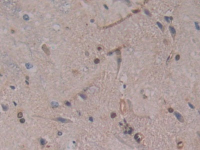 DAB staining on IHC-P; Samples: Rat Pancreas Tissue.