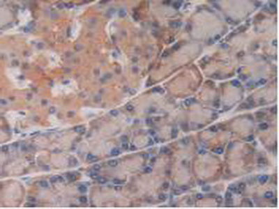 Glutathione S Transferase Theta 2 (GSTt2) Polyclonal Antibody - image 5