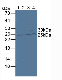 Western Blot; Sample: Recombinant GSTt2, Mouse.