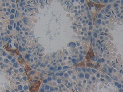 DAB staining on IHC-P; Samples: Mouse Kidney Tissue.