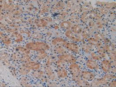 Glutathione S Transferase Theta 2 (GSTt2) Polyclonal Antibody - image 5