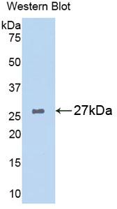 DAB staining on IHC-P; Samples: Rat Kidney Tissue;  Primary Ab: 10µg/ml Rabbit Anti-Rat GSTa1 Antibo