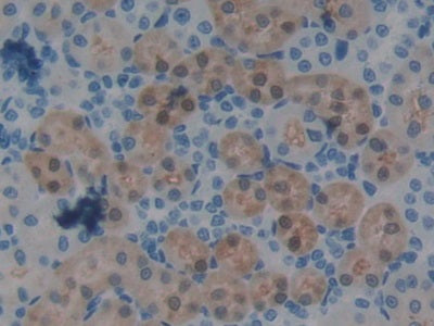 DAB staining on IHC-P; Samples: Rat Kidney Tissue