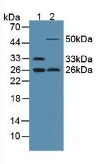 Western Blot; Sample: Recombinant ADP, Rat.