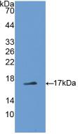 DAB staining on IHC-P; Samples: Rat Liver Tissue; Primary Ab: 10µg/ml Rabbit Anti-Rat ADP Antibody Second Ab: 2µg/mL HRP-Linked Caprine Anti-Rabbit IgG Polyclonal Antibody