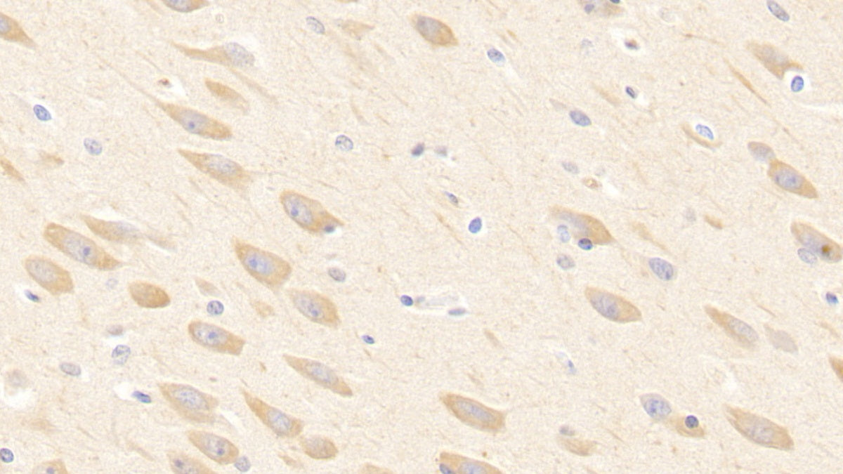 DAB staining on IHC-P; Samples: Porcine Cardiac Muscle Tissue;  Primary Ab: 10μg/ml Rabbit Anti-Porcine ADP Antibody Second Ab: 2µg/mL HRP-Linked Caprine Anti-Rabbit IgG Polyclonal Antibody