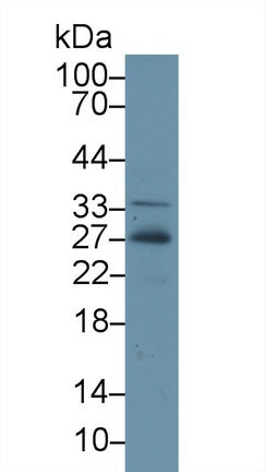 Western Blot; Sample: Recombinant protein.